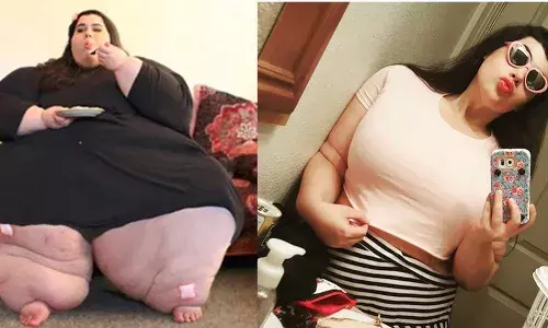 एक समय था 350 किलो वजन, आज मॉडलिंग  कर लोगों को कर रही हैं प्रेरित